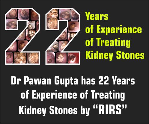 bilateral-kidney-stone-removal-in-dehradun